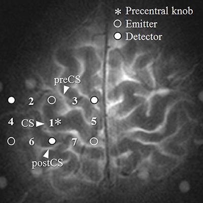 Vector-based analysis of cortical activity associated with dumbbell exercise using functional near-infrared spectroscopy